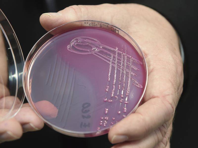 Researchers have developed a coating that can kill hospital infections on metal, including E-coli.